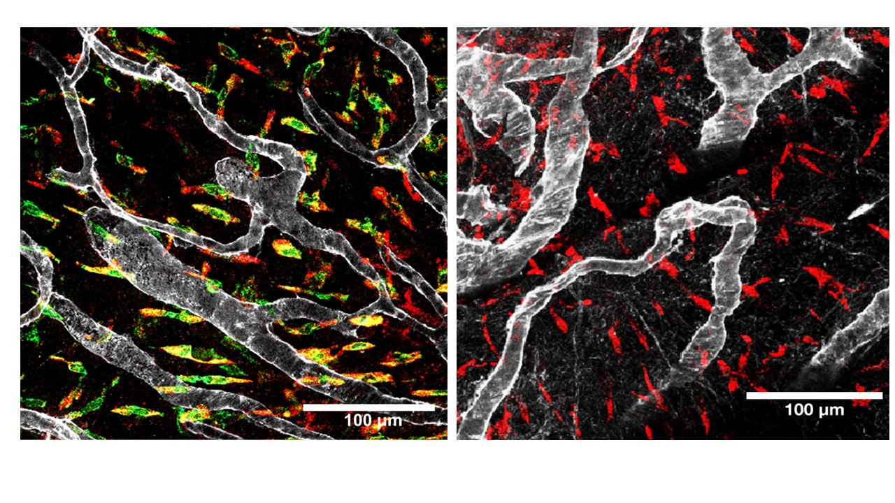  Immune cells and blood vessels in the meninges.